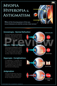 Myopia, Hyperopia & Astigmatism Poster