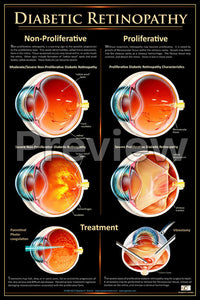 Diabetic Retinopathy Poster